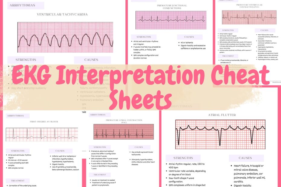 EKG Interpretation Cheat Sheet Free Download Ekg 49 OFF