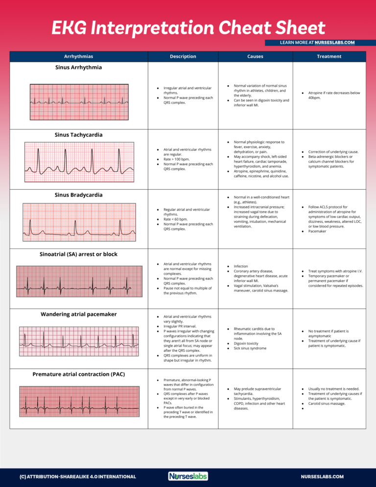Free Printable Ekg Interpretation Cheat Sheet Almuhja