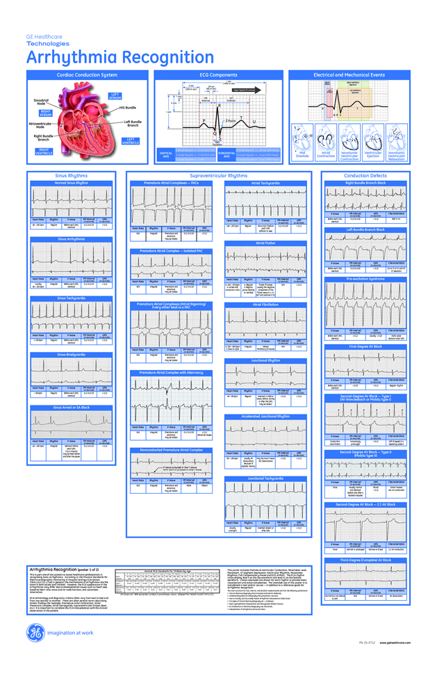 Free Printable Ekg Interpretation Cheat Sheet Printable New Year Banners