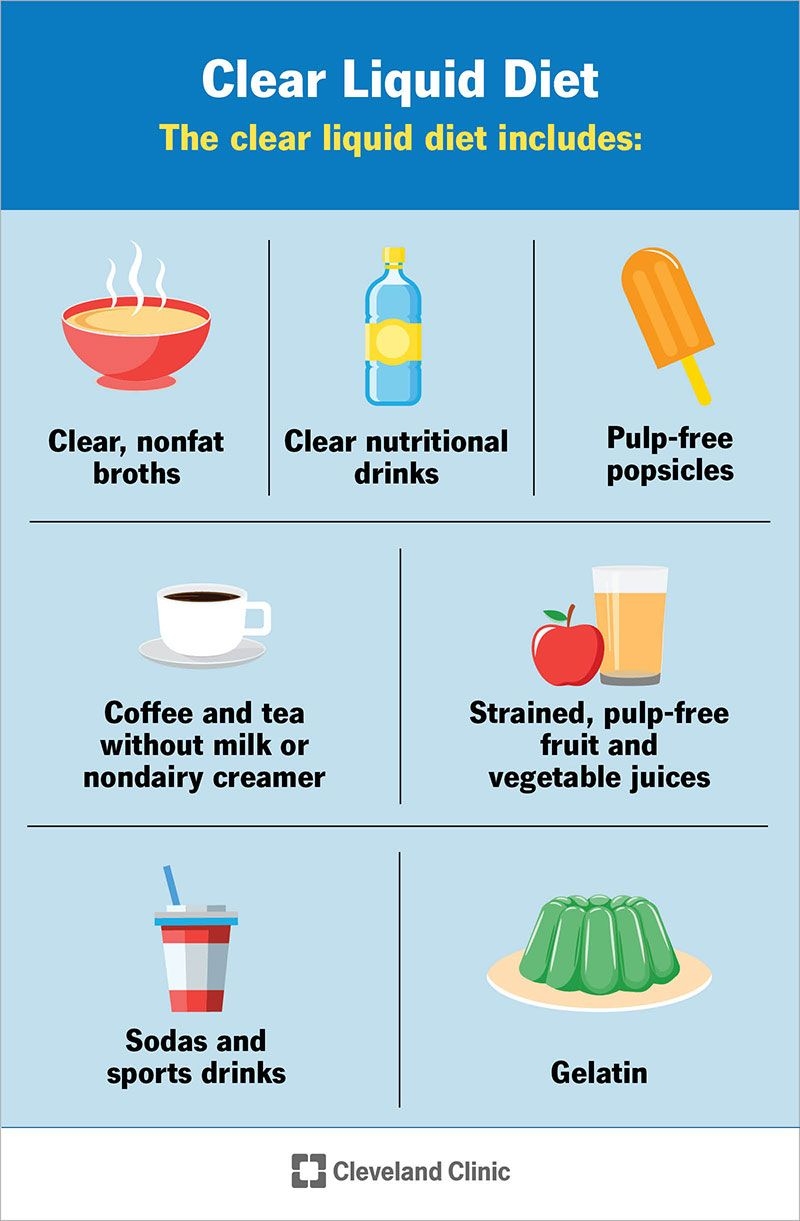 Printable 1 Week Colonoscopy Diet Sheet Dev onallcylinders