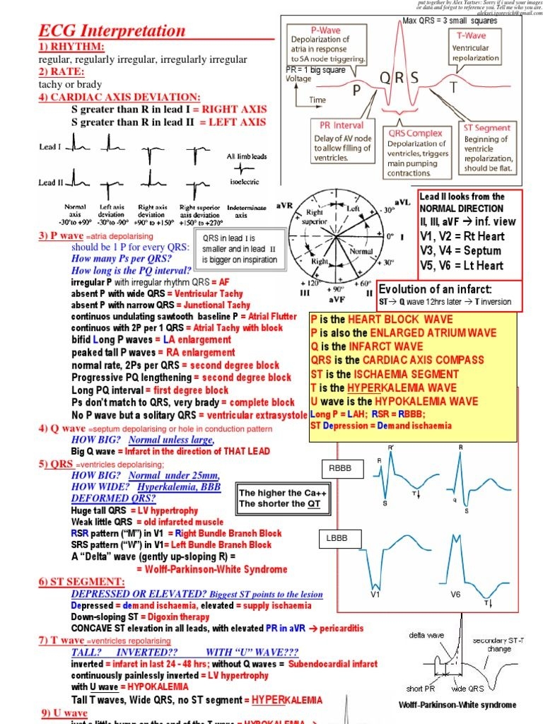 Printable 12 Lead Ekg Interpretation Cheat Sheet Dev onallcylinders