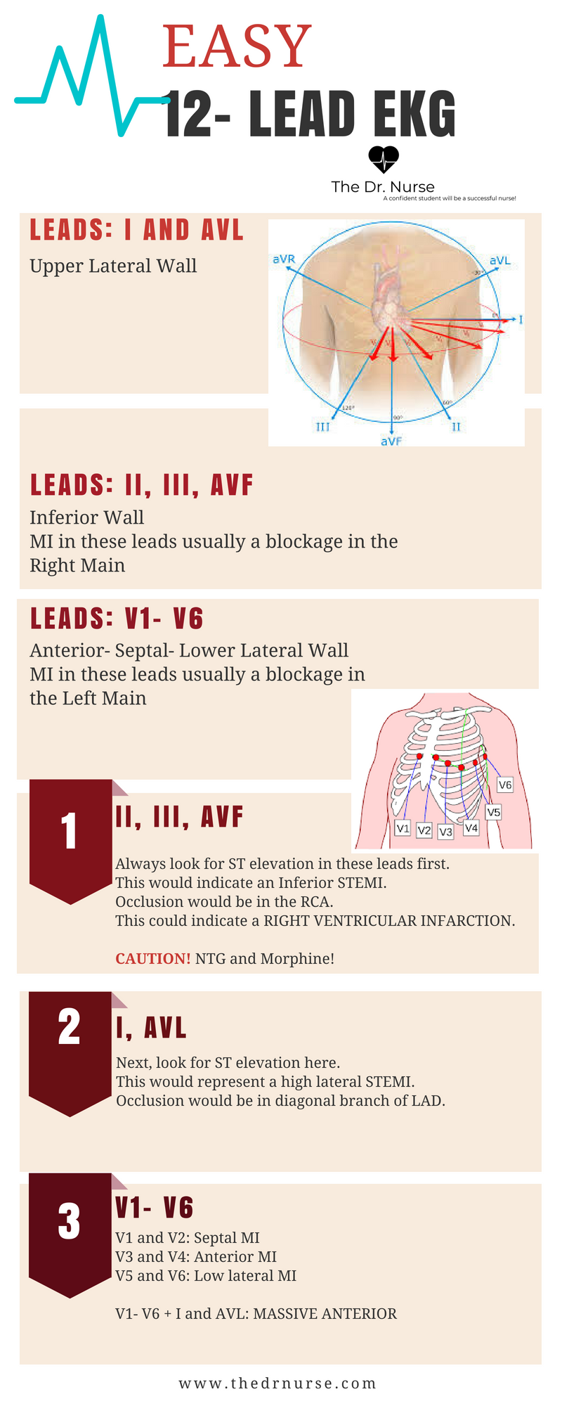 Printable 12 Lead Ekg Interpretation Cheat Sheet