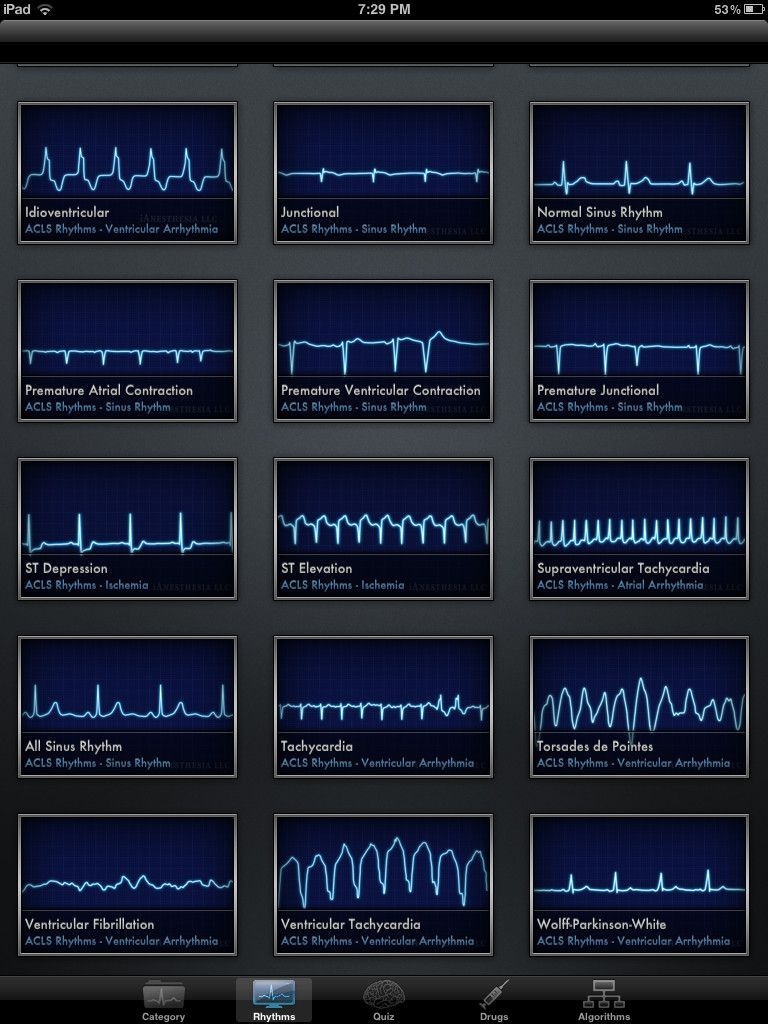 Printable Ekg Interpretation Cheat Sheet Bilarasa